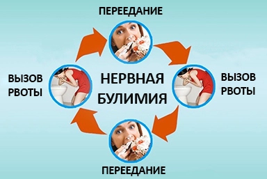 Лечение булимии в Абдулино